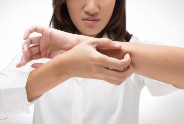 Jak wygląda uczulenie na kosmetyki?